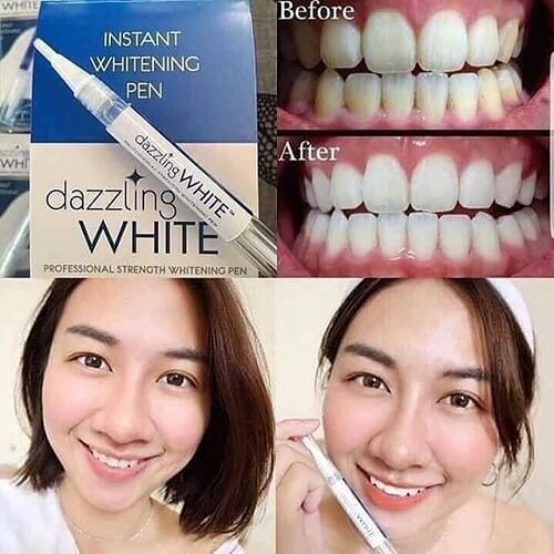 Bút tẩy trắng răng Dazzling White trả lại cho bạn hàm răng trắng sáng nhanh chóng