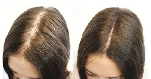 Các dưỡng chất có trong biotin collagen nhanh chóng tác động, kích thích mọc tóc, giúp sợi tóc chắc khỏe